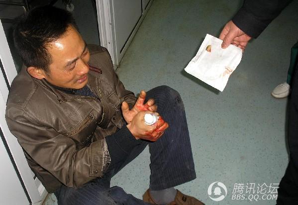 剁断手指就能真的戒赌了吗？